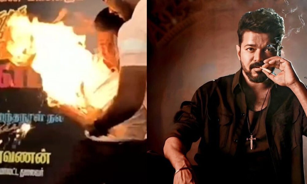 கையில் பற்றிய தீ…விஜய் பிறந்தநாள் கொண்டாட்டத்தில் விபரீதம்